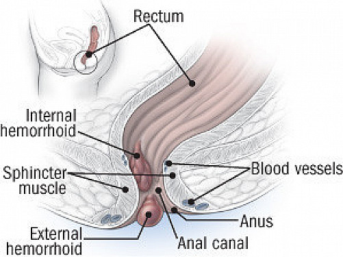 derek pierson recommends show me your anus pic