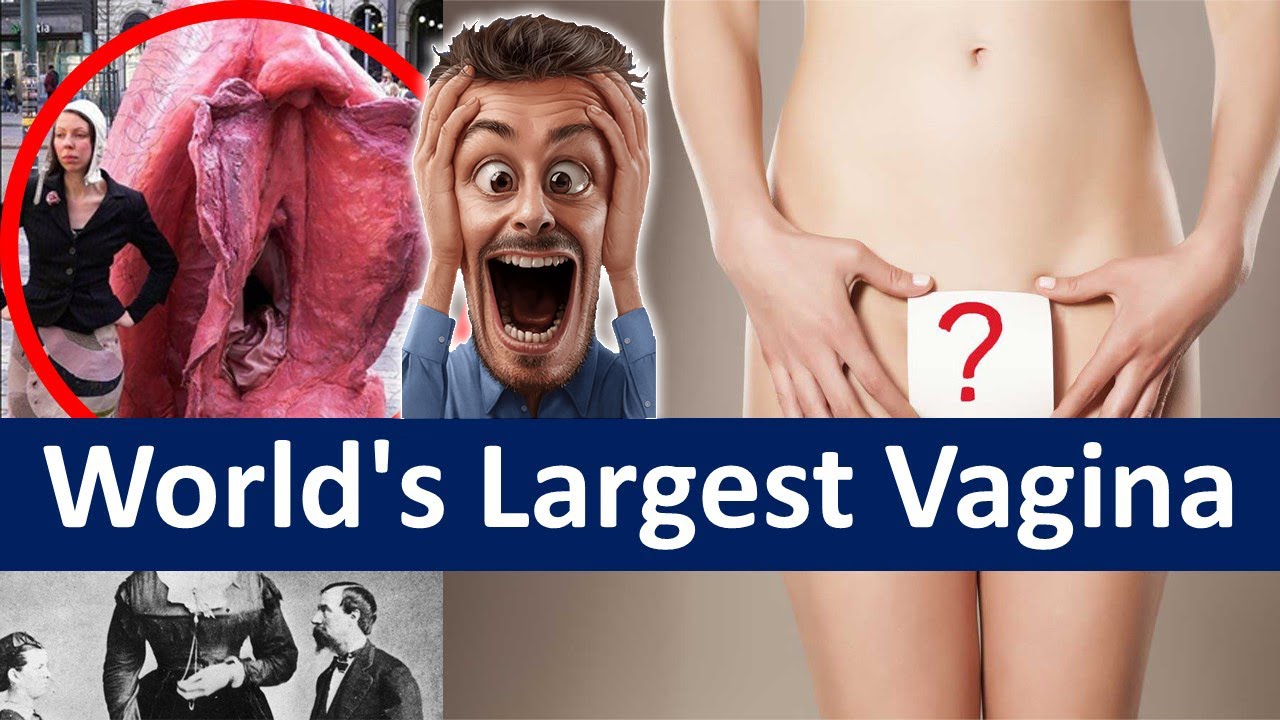 carol ritchings recommends Worlds Largest Vagina Pics